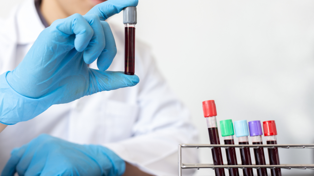 Understanding the Risks Associated with Blood Borne Pathogens